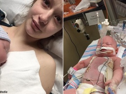 Новорожденная малышка умерла из-за поцелуя кого-то из друзей: герпес съел ее легкие и мозг