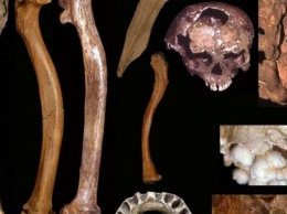 Антропологи обнаружили множественные аномалии развития у древних людей