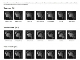 МРТ поможет ученым выяснить, как битбоксеры создают и имитируют звуки