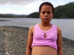 17-летняя девушка "забеременела" от рыбы (фото)