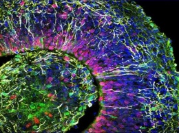 Ученые вырастили схожий с младенческим мини-мозг