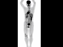 Трехмерное изображение человека вместо снимка: ученые разработали новейший сканер всего тела