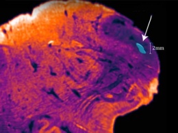 Нейробиологи обнаружили ранее скрытый участок в человеческом мозге