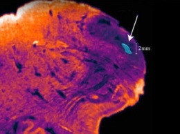В человеческом мозге нашли неизвестный участок