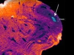 В человеческом мозге найден неизвестный участок