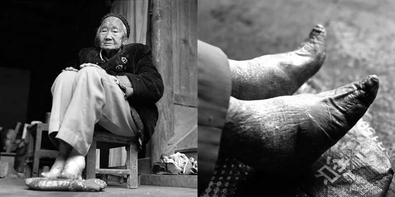Древние традиции: китайские «лотосовые ножки» как гарантия счастливого замужества