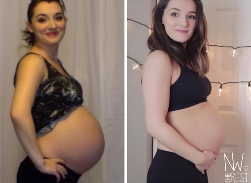 Мама опубликовала свои фото во время беременности двойней и одним ребенком. Разница удивила всех!
