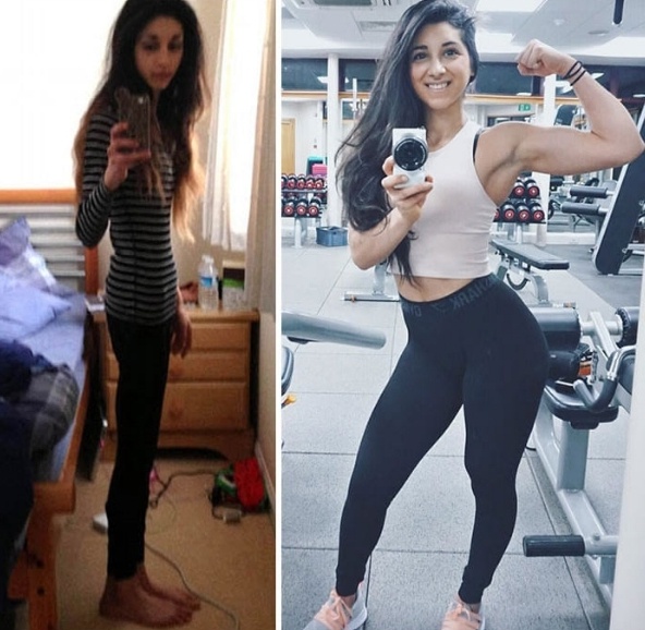 До и После: 15 фото людей, которые победили анорексию