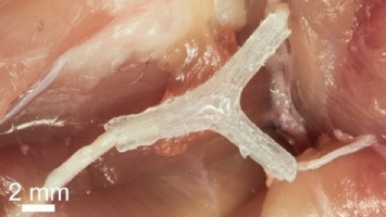 3D-печать поможет нейрохирургам в восстановлении поврежденных нервов