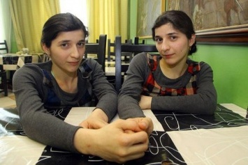 В Киргизии скончалась одна из сиамских близнецов Зита Резаханова