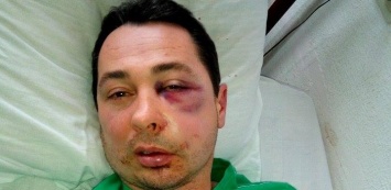 В Каховке избили депутата горсовета от БПП Хоминца