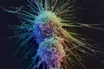 Ученые нашли способ, как вылечить рак