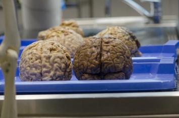 Биологи изучили реакцию головного мозга человека на телепортацию