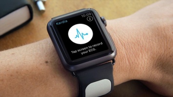 AliveCor представила ремешок для Apple Watch, позволяющий снимать ЭКГ [видео]