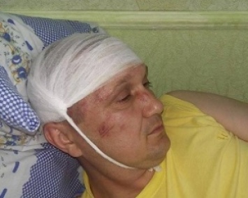 Депутата на Сумщине избили железными прутьями по голове (ФОТО)