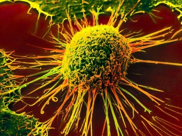 Ученые из Новосибирска нашли ген, способный победить рак