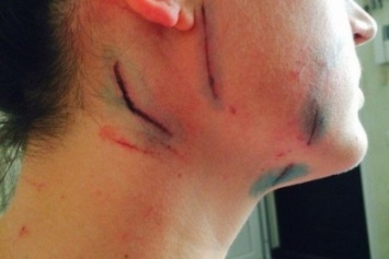 В Одессе парочка избила велосипедистку, но девушка нанесла удар намного больнее (ФОТО)