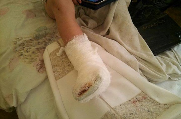 Зубков о травмированном в «Тайгане» ребенке: родители сами виноваты, что оставили его без присмотра (ФОТО)