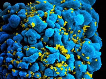 В США разработан тест для оценки риска заражения ВИЧ