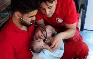 В Сирии сиамские близнецы Наврас и Моаз не дождались операции по разделению