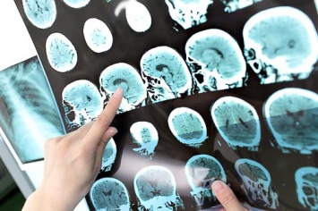 Новые впечатления улучшают работу мозга - ученые