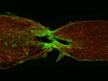 Ученые выяснили, как рыбки восстанавливают разорванный спинной мозг