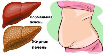 6 явных признаков того, что Ваша печень полна токсинов и вредных элементов!