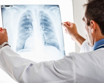 Ученые смогут предсказывать возникновение рака легких у некурящих
