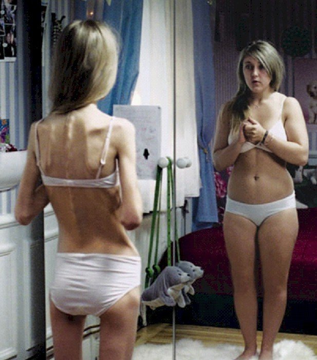 Ученые: Большинство подростков неадекватно оценивают свой вес