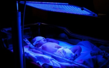 В Павлограде появился аппарат для лечения желтухи у новорожденных