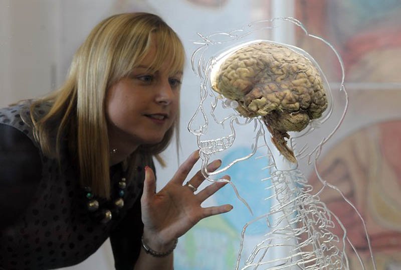 Ученые: Найдено универсальное лекарство от тяжелых заболеваний мозга