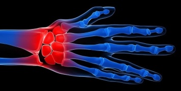 Ревматоидный артрит влияет на воспаление десен - Ученые