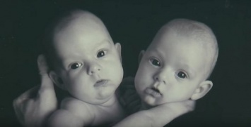 Чтобы разделить этих близняшек, медики трудились 12 часов. Вот какими стали малышки через 10 лет