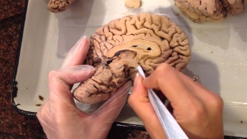 Ученые узнали, откуда у человека появился мозг