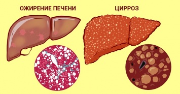 А что, если печень можно вылечить травами? 5 проверенных тысячами людей рецептов