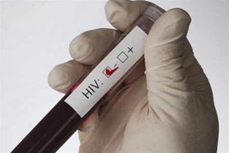 Медицинские учреждения получили быстрые тесты для выявления ВИЧ