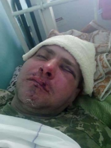 Чудом остался жив: в Измаиле жестоко избили бойца "Правого сектора" за участие в АТО