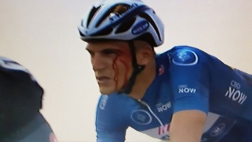 Украинский велогонщик разбил в кровь лицо лидеру многодневки "Тур Дубая"