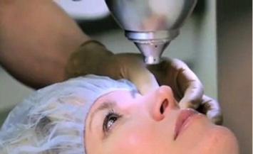 В Запорожье операция по замене хрусталика глаза стала доступнее для льготников