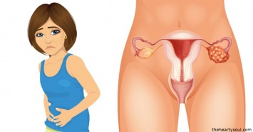 4 ранних симптома рака яичников, о которых должна знать каждая женщина