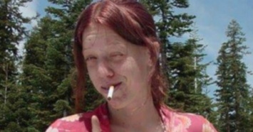Метамфетаминовая наркоманка поделилась своим фото после излечения. Ее не узнать!