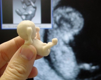 Ученые: Технология скрининга эмбрионов является недоработанной