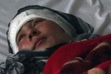 Шокирующий случай в Афганистане: муж-изверг отрезал уши своей жене