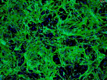 Нейроглию превратили в нейроны in vivo