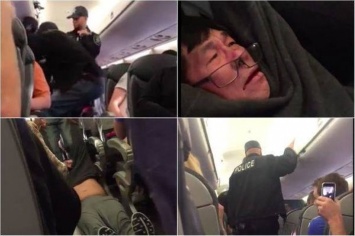 Пассажиру, которого силой вынесли с борта United Airlines, нужна пластическая операция