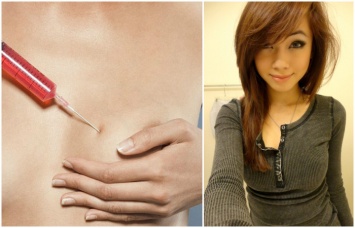 «Золушкин бюст»: в Японии предлагают дешево увеличить грудь на 24 часа