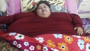 Эта женщина за 2 месяца потеряла 323 кг, сделав операцию для похудения. Но все оказалось куда сложнее, чем она хотела