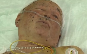В больнице Днепра пришел в сознание раненый боец