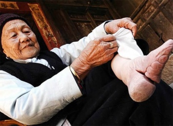 Эта старая китаянка показала, к чему приводит бинтование ступней согласно древней традиции. Кошмарное зрелище!