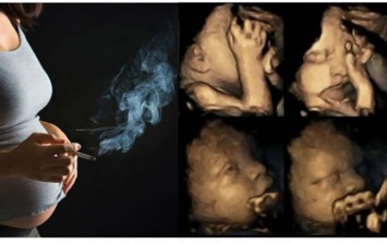 Беременные женщины продолжают курить сигареты. Теперь посмотрите, что делают их дети на УЗИ!